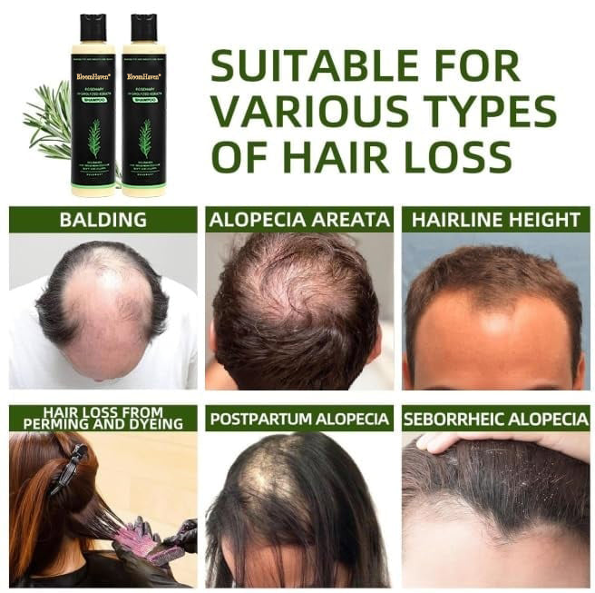 🔥BloomHaven® Organic Rosemary Hair Growth Shampoo